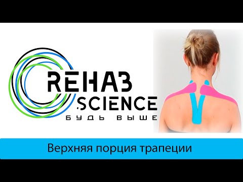 Видео: Кинезиотейпирование при боли в шее. Тейпирование верхней порции трапецевидной мышцы.
