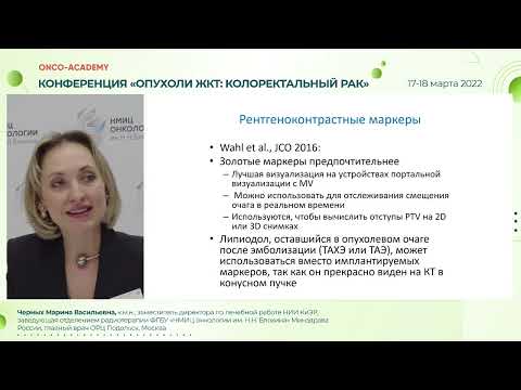 Видео: Чем лучевой терапевт может помочь в лечении олигометастатического КРР? Черных М.В.