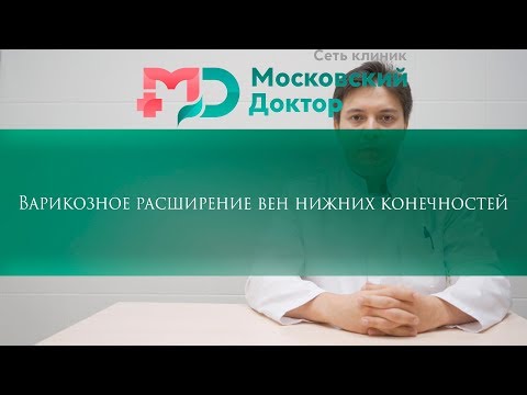 Видео: Варикозное расширение вен нижних конечностей