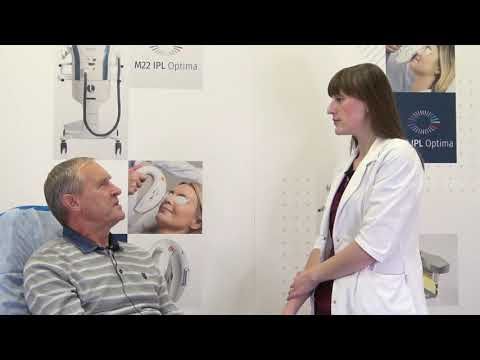 Видео: IPL-терапия в лечении синдрома сухого глаза