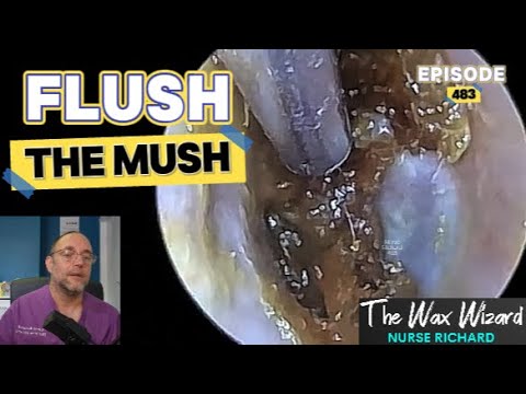 Видео: Смойте кашу! Эпизод 483