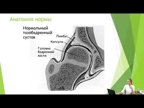 Видео: Дисплазия тазобедренных суставов.