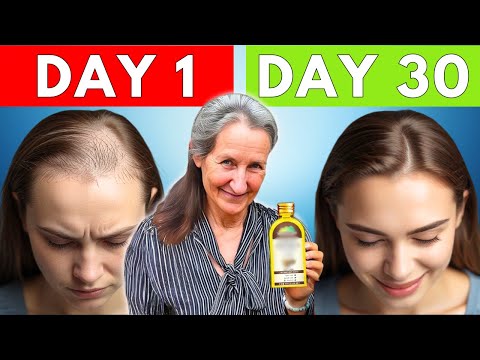 Видео: «ШОКИРУЮЩИЙ секрет — используйте это перед сном и ОТРАСТИТЕ ВОЛОСЫ СНОВА!» — Барбара О'Нил