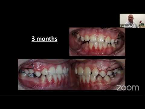 Видео: Последователи на дисциплината "Алекзандър" - епизод 17: д-р Радой Димитров