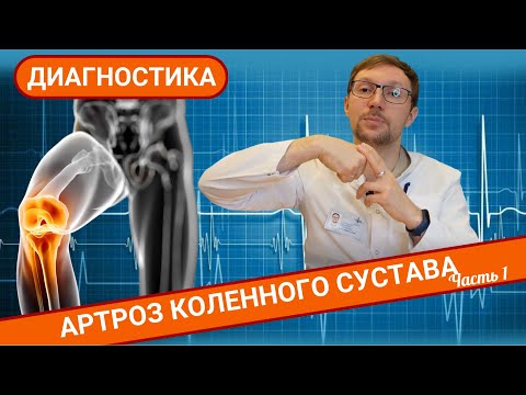 Видео: АРТРОЗ КОЛЕННОГО СУСТАВА. ДИАГНОСТИКА. (Часть 1)