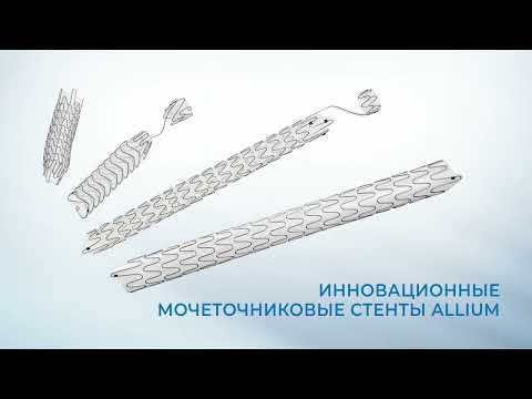 Видео: Саморасширяющиеся стенты Allium