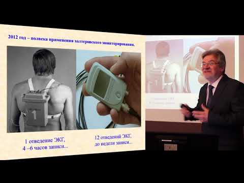 Видео: Основы холтеровского мониторирования ЭКГ