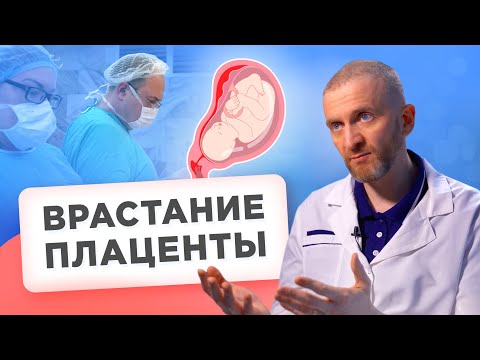 Видео: Беременность и роды с врастанием плаценты. Что нужно знать?