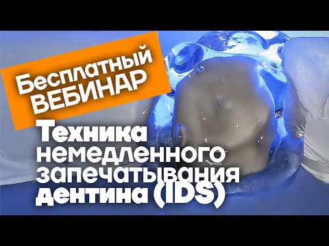 Видео: Техника немедленного запечатывания дентина. Бесплатный вебинар.