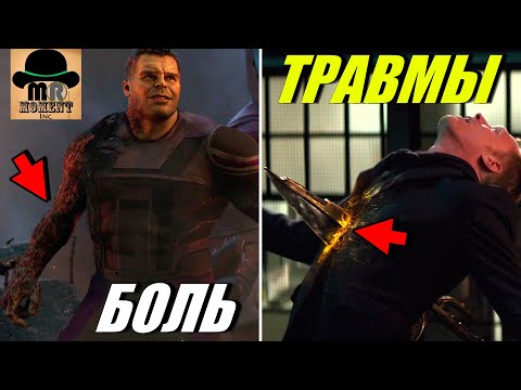 Видео: 😫 Эти 8 СУПЕРГЕРОЕВ ПЕРЕЖИЛИ КРАЙНЕ ЖУТКИЕ ФИЗИЧЕСКИЕ ТРАВМЫ [Киновселенная Марвел]