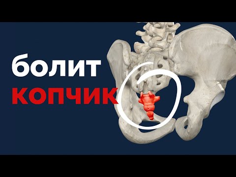 Видео: Болит копчик? Быстрая помощь!