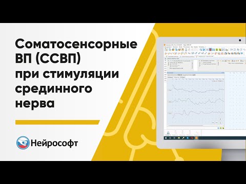 Видео: Соматосенсорные вызванные потенциалы (ССВП) при стимуляции срединного нерва
