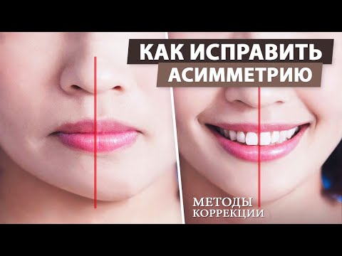 Видео: Асимметрия лица - причины возникновения. Как исправить асимметрию лица