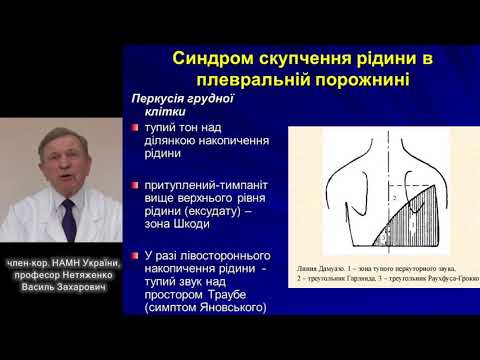 Видео: Лекція: "Основні синдроми при захворюваннях органів дихання"