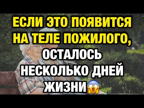 Видео: Если это появилось в вашем теле — смерть может быть ближе, чем вы думаете…