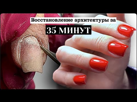 Видео: ИДЕАЛЬНЫЕ КРАСНЫЕ НОГТИ ❤️/ реставрация архитектуры/ верхние формы