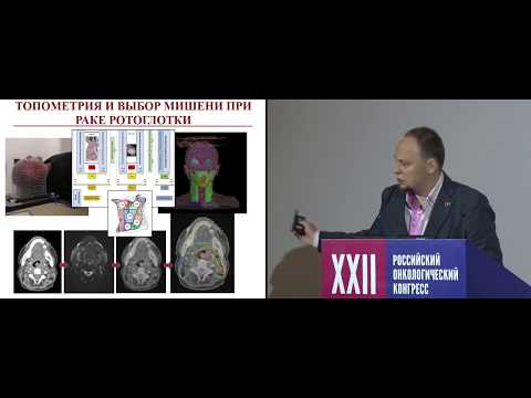 Видео: Альтернативные схемы интенсификации и деинтенсификации химиолучевой и биолучевой терапии