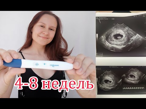 Видео: 4-8 Недель Беременности. Первое УЗИ. Токсикоз. Отслойка