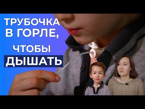 Видео: АТРЕЗИЯ ТРАХЕИ | История Ветошкина Филиппа