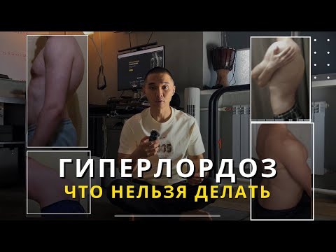 Видео: Гиперлордоз — можно ли тренироваться?