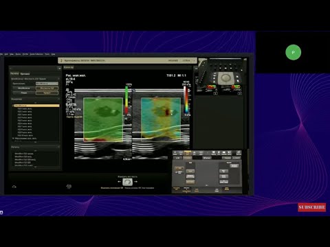 Видео: Алгоритм проведения эластометрии на УЗ-системах Philips EPIQ, Affiniti