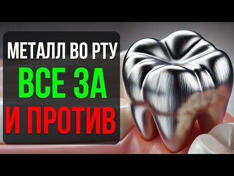 Видео: Металлические коронки на зубы: Всё, что нужно знать!