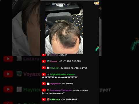 Видео: Лысение продолжается