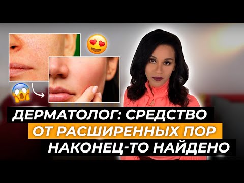 Видео: Дерматолог: Избавиться от расширенных пор навсегда? Лучшее средство от расширенных пор /Сузить поры