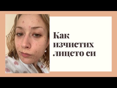 Видео: Как изчистих лицето си
