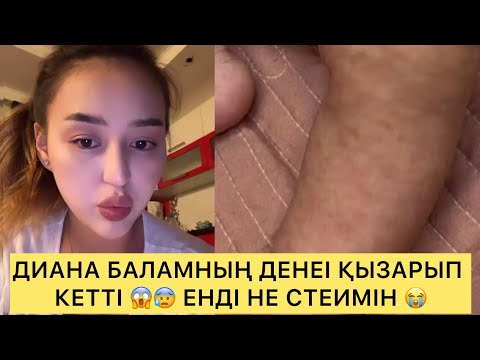 Видео: ДИАНА БАЛАМНЫҢ ДЕНЕСІ ҚЫЗЫРЫП КЕТТІ 😱😰ЕНДІ НЕ СТЕЙМІН 😭