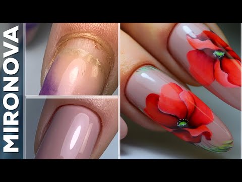 Видео: Мясистая кутикула / Коррекция ногтей гелем  /  Рисую маки гель лаками