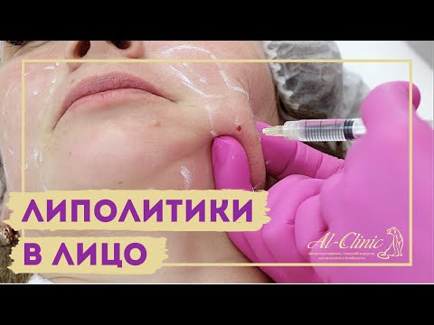 Видео: ХУДЕЕМ БЫСТРО | ЛИПОЛИТИКИ В ЛИЦО | Избавляемся от второго подбородка | "Light Fit" от лишнего жира