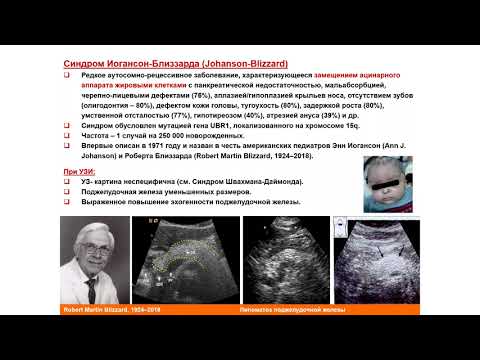 Видео: УЗИ. Доктор Иогансен. Выпуск 46. Аномалии развития поджелудочной железы. Часть 1.
