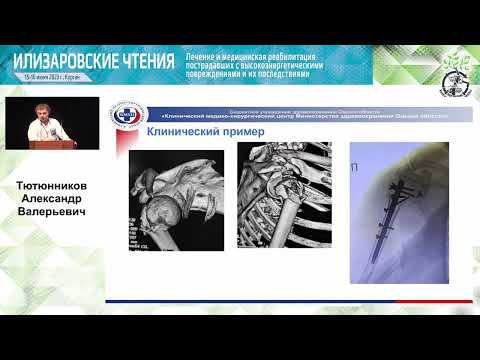 Видео: Илизаровские чтения  15 июня 2023   Сателлитные мероприятия