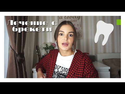 Видео: МОЕТО ЛЕЧЕНИЕ С БРЕКЕТИ | КЪДЕ, КАК И КОЛКО?