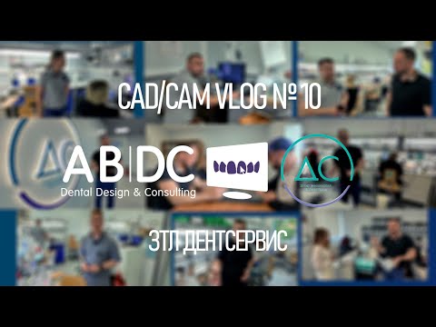 Видео: CAD/CAM VLOG 10: ДЕНТСЕРВИС - КРУПНЕЙШАЯ ЗТЛ САНКТ-ПЕТЕРБУРГА