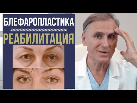 Видео: БЛЕФАРОПЛАСТИКА 🔥 РЕАБИЛИТАЦИЯ ВАЖНА ИЛИ НЕТ❓