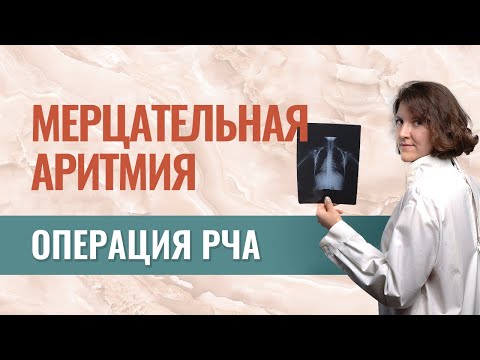 Видео: РЧА. Хирургическое лечение мерцательной аритмии