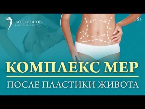Видео: Как получить хороший результат после абдоминопластики? / 18+
