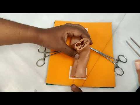 Видео: Симутомия: изучение кишечного анастомоза «конец в конец» (тип B) #кишечныйанастомоз #наложениекиш...