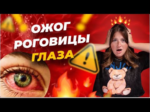 Видео: Ожог глаза при наращивании ресниц | Что делать?