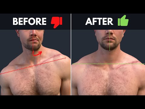 Видео: Ваша челюсть портит осанку?