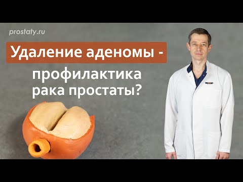 Видео: Удаление аденомы - профилактика рака простаты?