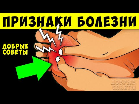 Видео: Как по Ступням за 10 сек. узнать, что Ваше тело просит о Помощи