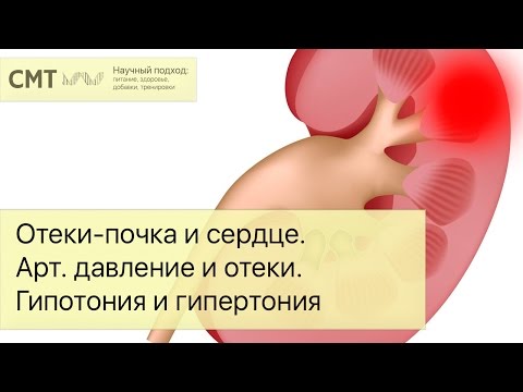 Видео: Отеки - почка и сердце. Артериальное давление и отеки. Гипотония и гипертония