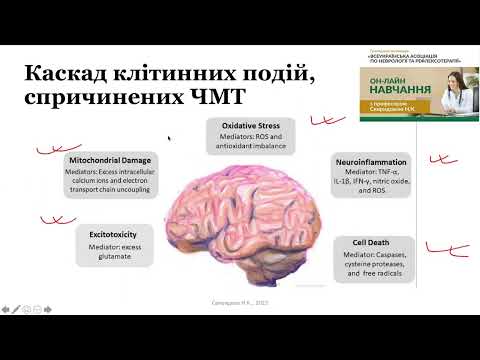 Видео: Черепно-мозкова травма (діагностика та лікування)