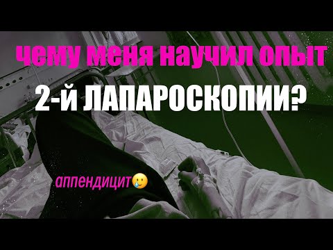 Видео: Иногда нужно потерять аппендикс, чтобы найти веру в людей. Чему меня научил опыт 2-й лапароскопии?