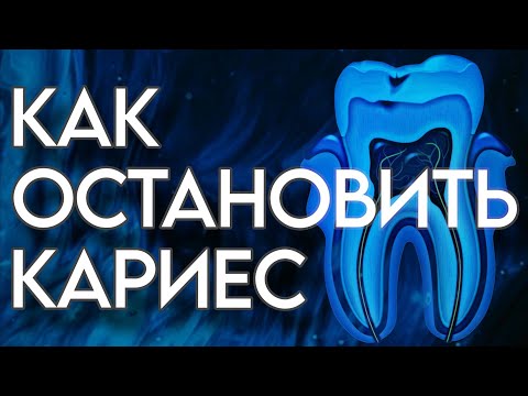 Видео: Всё про кариес и как с ним бороться