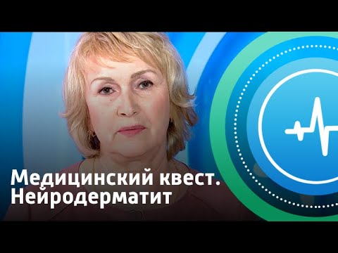 Видео: Нейродерматит. Медицинский квест | Телеканал «Доктор»