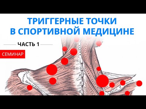 Видео: Триггерные точки в спортивной медицине и не только (Семинар от 12.05.2018 - ЧАСТЬ 1)